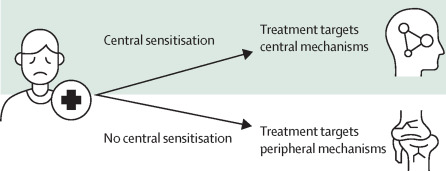 Foto 5: Billedet illustrerer behandlingstilgang afhængig af om det omhandler kroniske smerter med central sensibilisering eller smerter i bevægeapparatet uden central sensibilisering.