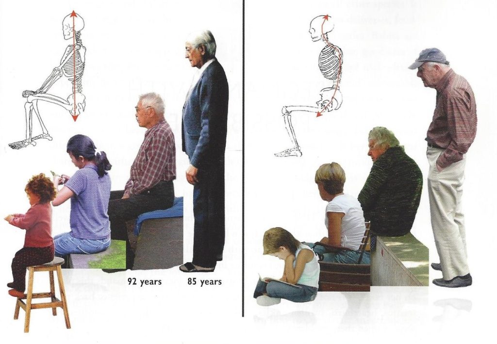 Foto 3: En kropsholdningsanalyse fortæller meget om bindevævsarkitekturen i kroppen.